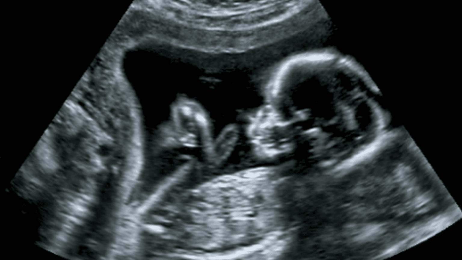 Debunking the Pro-abortion Narrative from a Secular Perspective